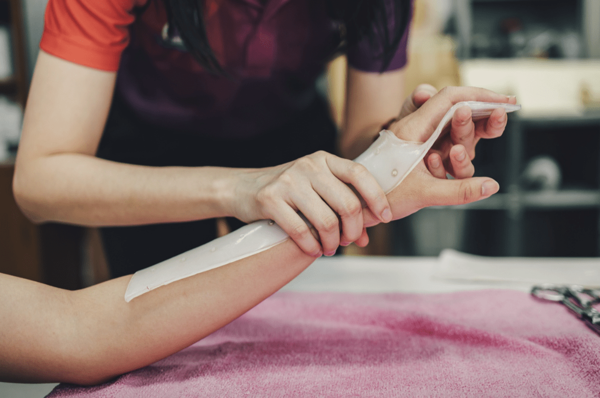 Hand Therapy: A highly skilled practice