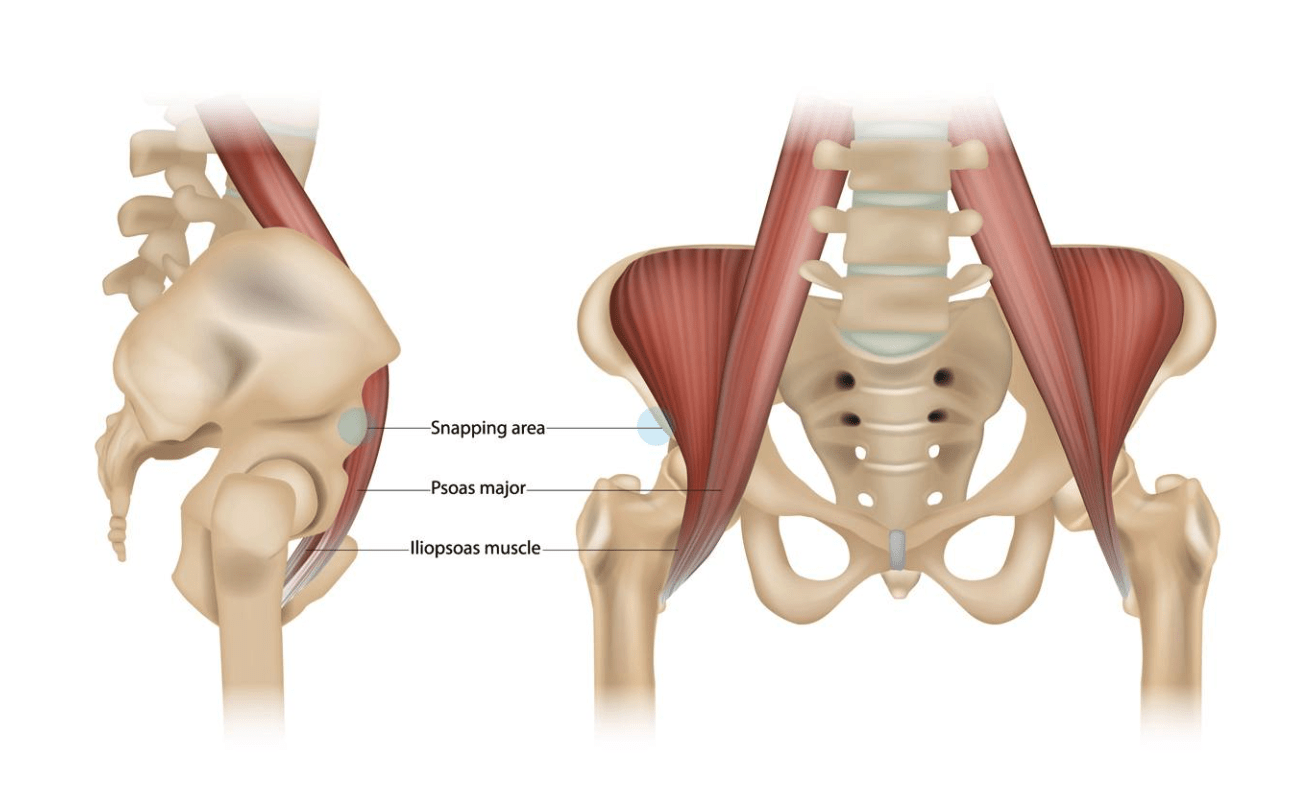 What is Snapping Hip?